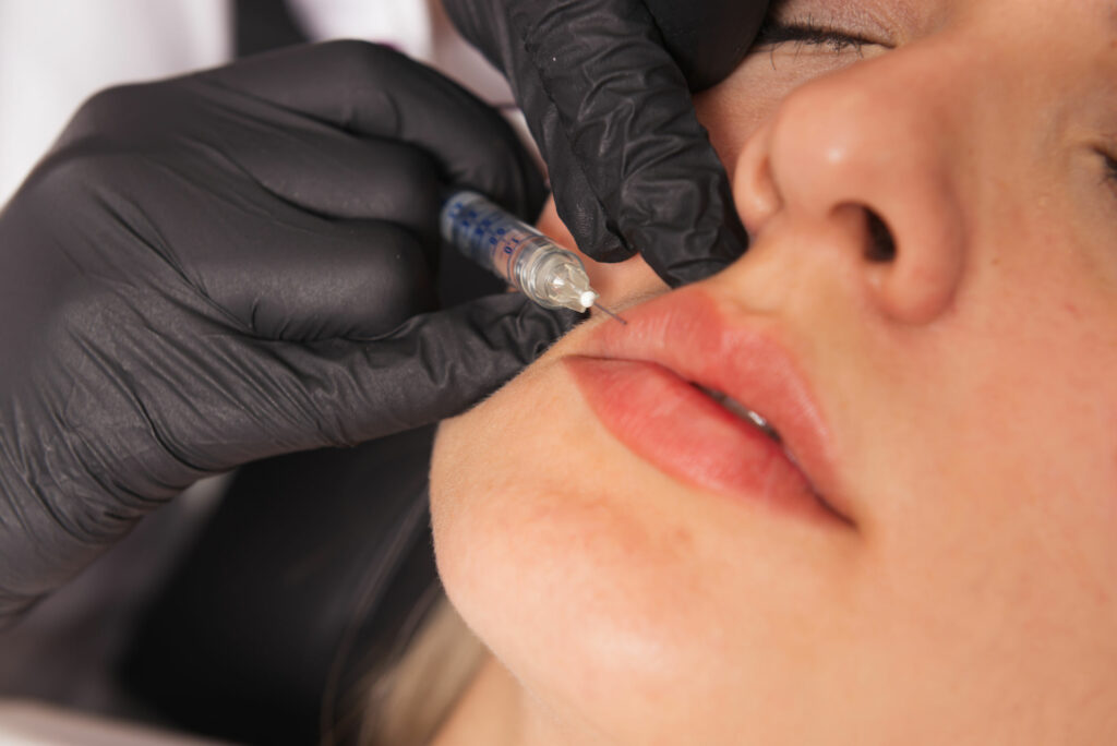 Fillers – Amsterdam Cosmetic Clinic