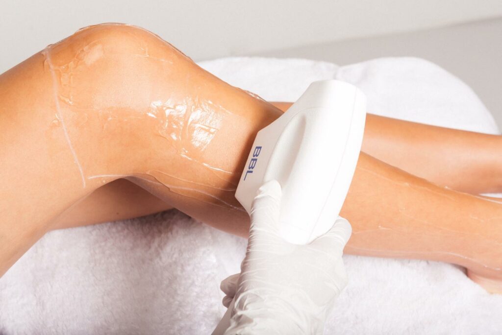 Laser hair removal – Amsterdam Cosmetic Clinic