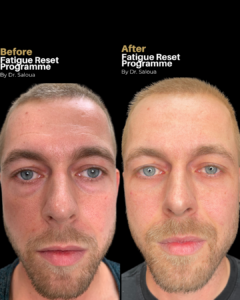 Fatigue Reset Programme