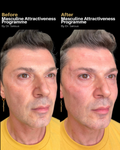 Masculine Attractiveness Programme