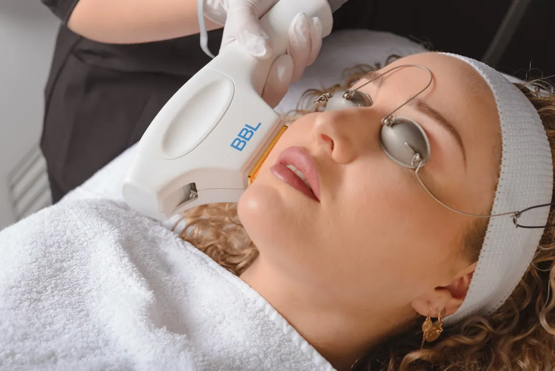 Sciton BBL-behandeling bij Amsterdam Cosmetic Clinic