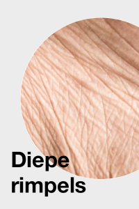 Diepe rimpels / Deep wrinkles