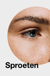 Sproeten / Freckles